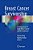 Breast Cancer Survivorship: Consequences Of Early Breast Cancer And Its Treatment-.. - Imagem 1