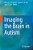 Imaging The Brain In Autism-.. - Imagem 1