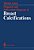Diagnosis And Differential Diagnosis Of Breast Calcifications-.. - Imagem 1