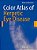 Color Atlas Of Herpetic Eye Disease: A Practical Guide To Clinical Management-.. - Imagem 1