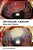 Ophthalmic Tumours: Including Lectures Presented At The Boerhaave Course On "Ophthalmic Tumours" Of The Leiden Medical Faculty, Held In Leiden, The Ne-.. - Imagem 1