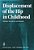 Displacement Of The Hip In Childhood: Aetiology, Management And Sequelae-.. - Imagem 1