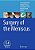 Surgery Of The Meniscus-.. - Imagem 1