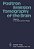 Positron Emission Tomography Of The Brain-.. - Imagem 1