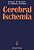 Cerebral Ischemia-.. - Imagem 1