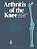 Arthritis Of The Knee: Clinical Features And Surgical Management-.. - Imagem 1