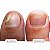 MICOZIONE FORTALECEDOR E REPARADOR DE UNHAS 10ML - Imagem 3