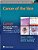 Cancer Of The Skin - Cancer, Principles And Practice Of Oncology-.. - Imagem 1