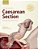 Textbook Of Caesarean Section-.. - Imagem 1