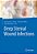 Deep Sternal Wound Infections-.. - Imagem 1