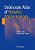 Endoscopic Atlas Of Pediatric Otolaryngology-.. - Imagem 1