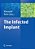 The Infected Implant-.. - Imagem 1