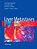 Liver Metastases-.. - Imagem 1