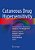 Cutaneous Drug Hypersensitivity: Clinical Features, Mechanisms, Diagnosis, And Management-.. - Imagem 1