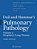 Dail And Hammar's Pulmonary Pathology: Volume II: Neoplastic Lung Disease-.. - Imagem 1