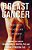 Breast Cancer: Society Shapes An Epidemic-.. - Imagem 1