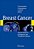 Breast Cancer: Nuclear Medicine In Diagnosis And Therapeutic Options-.. - Imagem 1