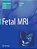 Fetal Mri-.. - Imagem 1