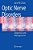 Optic Nerve Disorders: Diagnosis And Management-.. - Imagem 1