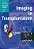 Imaging In Transplantation-.. - Imagem 1