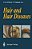 Hair And Hair Diseases-.. - Imagem 1