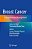 Breast Cancer: Comprehensive Management-.. - Imagem 1