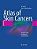 Atlas Of Skin Cancers: Practical Guide To Diagnosis And Treatment-.. - Imagem 1