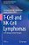 T-Cell And Nk-Cell Lymphomas: From Biology To Novel Therapies-.. - Imagem 1