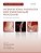 Challenging Concepts In Interventional Radiology-.. - Imagem 1