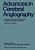 Advances In Cerebral Angiography: Anatomy - Stereotaxy - Embolization Computerized Axial Tomography-.. - Imagem 1