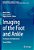 Imaging Of The Foot And Ankle: Techniques And Applications-.. - Imagem 1