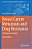 Breast Cancer Metastasis And Drug Resistance: Challenges And Progress-.. - Imagem 1