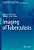 Imaging Of Tuberculosis-.. - Imagem 1
