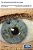 The Intraocular Implant Lens Development And Results With Special Reference To The Binkhorst Lens: Proefschrift-.. - Imagem 1