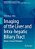 Imaging Of The Liver And Intra-Hepatic Biliary Tract: Volume 2: Tumoral Pathologies-.. - Imagem 1