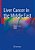 Liver Cancer In The Middle East-.. - Imagem 1