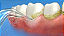 Bico Jato Clássico Waterpik - Classic Jet Tip - Imagem 3