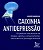 Caixinha Antidepressao: 100 Praticas com Tecnicas de Terapia Cognitivo-comp - Imagem 1
