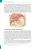 Livro Introdução à Ultrassonografia de Abdome, fundamentos físicos, formação da imagem e aplicações clínicas - Imagem 5