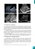 Livro Introdução à Ultrassonografia de Abdome, fundamentos físicos, formação da imagem e aplicações clínicas - Imagem 6