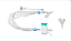 Sonda Aspiração Sistema Fechado Neonatal / Pediátrico 6fr 32cm - Bioteq - Imagem 1