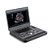 Equipamento de Ultrassom e Elastografia Doppler Colorido Portátil SonoScape X3 - Imagem 1