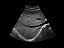 Equipamento de Ultrassom e Elastografia Doppler Colorido Portátil SonoScape X3 - Imagem 2