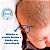 Mustela Stelaker Crosta Láctea 40ml - Imagem 3