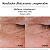 Creme Facial Antissinais Neutrogena Retinol Boost 0,1% 30ml - Imagem 4