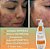 SABONETE LIQUIDO BARBATIMÃO TRATAMENTO ACNES 250 ml - Imagem 2