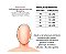 Cinta Facial Pós Bichectomia E Procedimentos Estéticos em Geral - Imagem 4