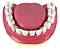 Dentição com Todos os Dentes Removíveis - Imagem 2