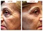 Resveratrol - Trans Resveratrol Gold | Compre 3 e Leve 5 - Imagem 3