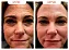 Resveratrol - Trans Resveratrol Gold | Compre 1 e Leve 2 - Imagem 3